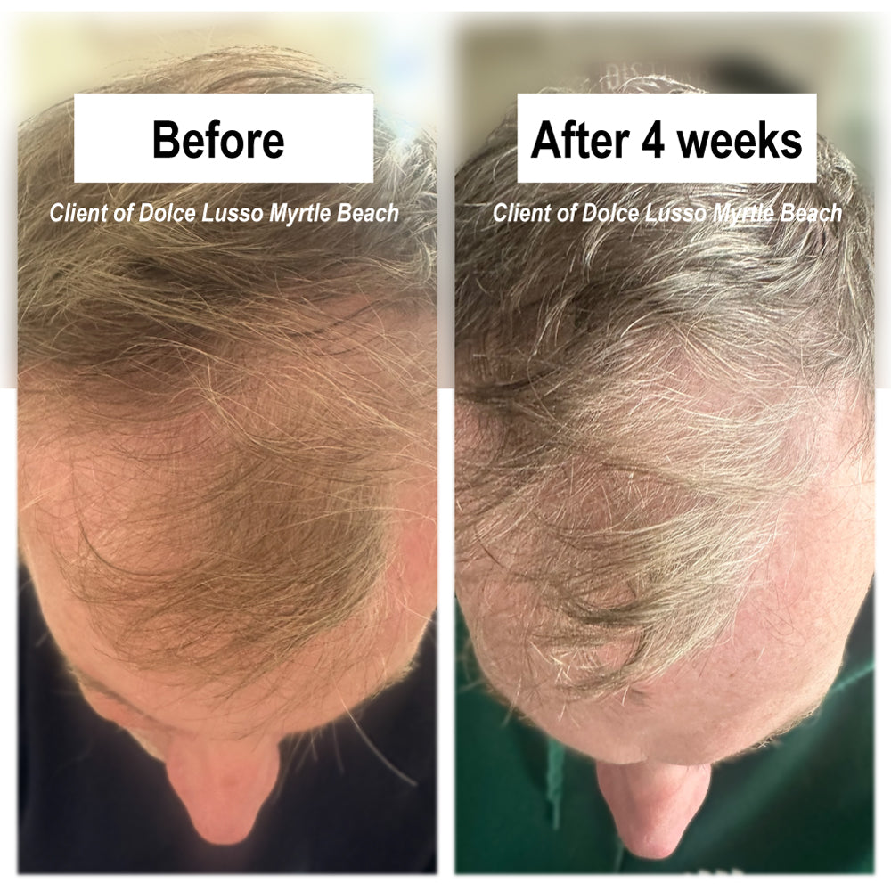 Serene Scalp Densifying Full Set