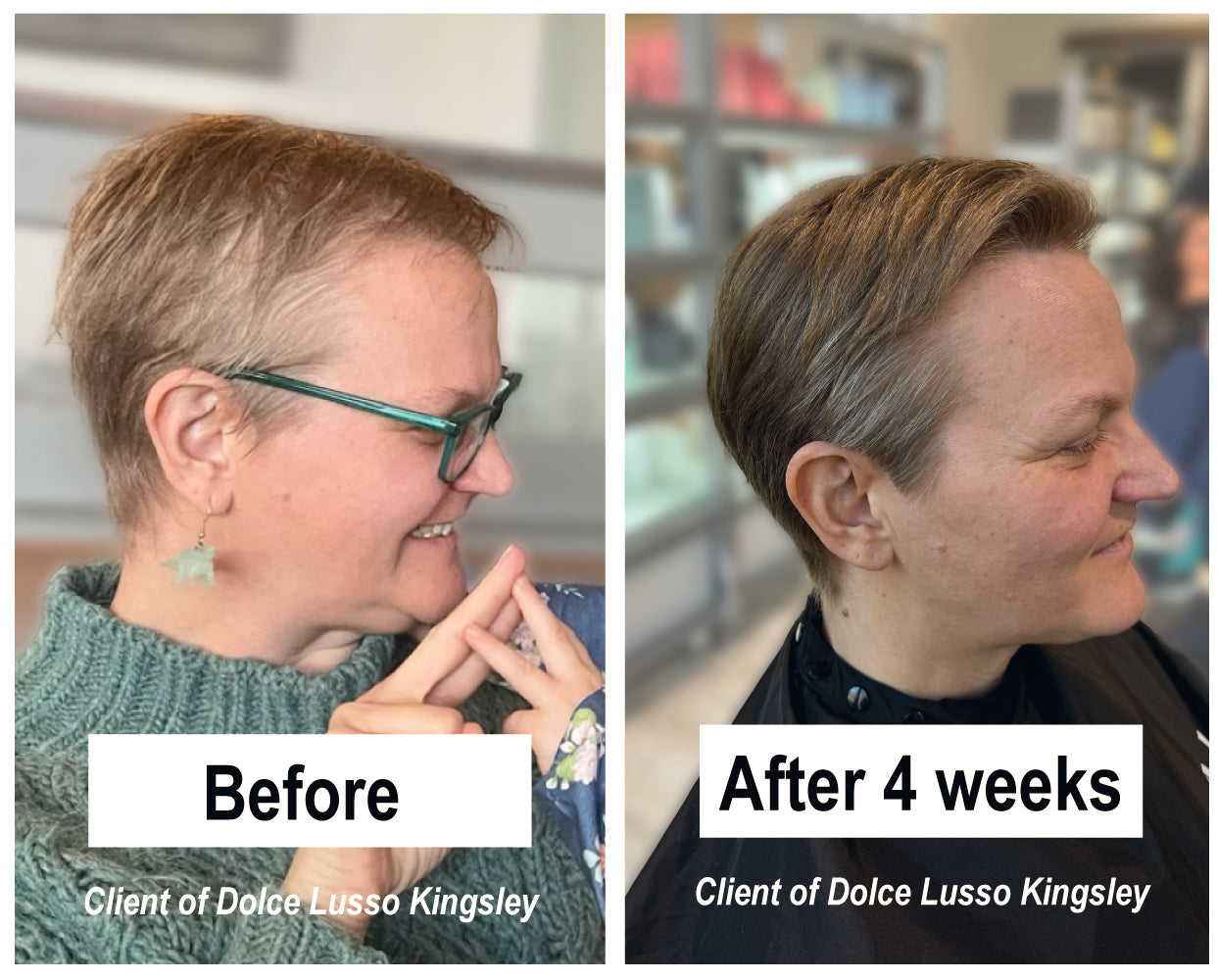 Serene Scalp Densifying Full Set